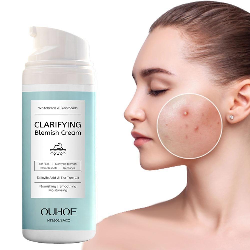 Crema all'Acido Salicilico per - Salicylic Acid Blackhead Remover recensione e prezzo