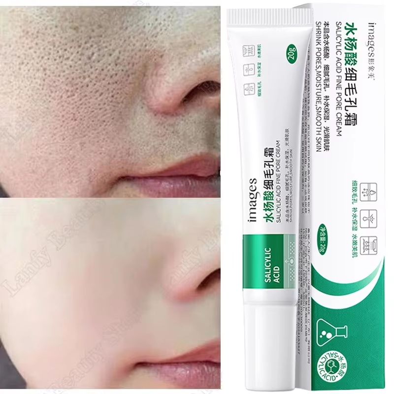 Crema Purificante con Acido Sa - Salicylic Acid Blackhead Remover recensione e prezzo